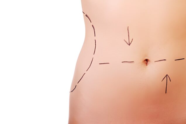 Cosmetic Surgery Package